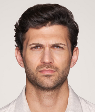 Other Aesthetic Treatments-before