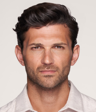 Other Aesthetic Treatments-after