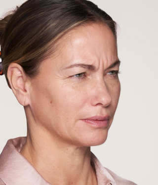 Other Aesthetic Treatments-before