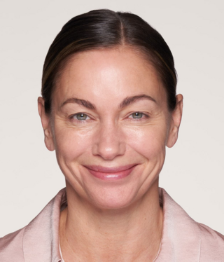 Other Aesthetic Treatments-after