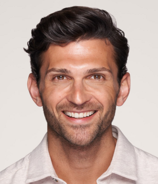 Other Aesthetic Treatments-after