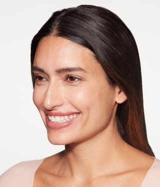 Sculptra® Regenerative biostimulator-before