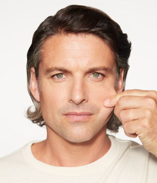 Sculptra® Regenerative biostimulator-before