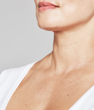 Restylane® SKINBOOSTERS™-before