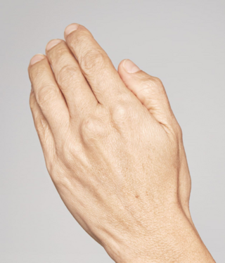 Other Aesthetic Treatments-before