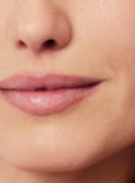 restylaneskinboosters_hp_m