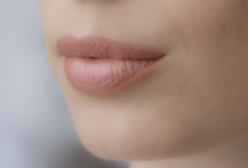 Fine Lines and Wrinkles-right-image