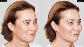Before and after