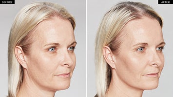 Before and after gallery