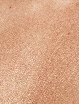 Dry skin can happen for many reasons. Which treatments are best for you?