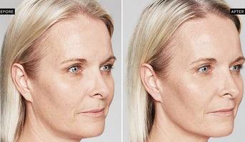Injectables