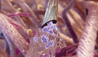 Galderma aesthetic - What does collagen do in the skin