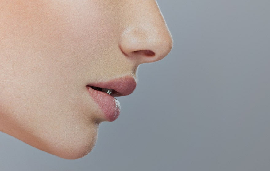 Nose Job with Restylane Fillers