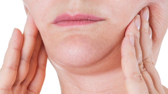 Sculptra treatment