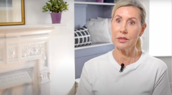 Gina's Sculptra Story