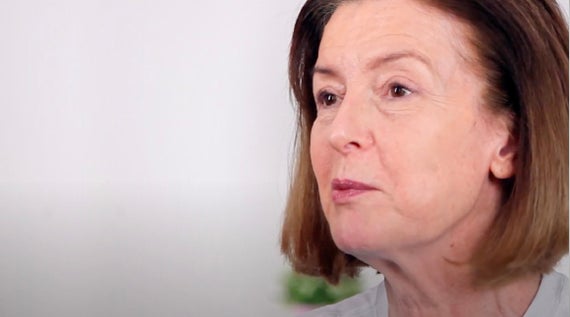 Hilary's Sculptra Story