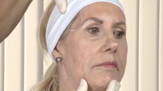 CHANGES IN BONE STRUCTURE AS WE AGE