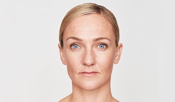 The Effect of Ageing on the Lips